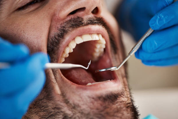 Best Urgent Dental Care for Toothache in Independence, IA